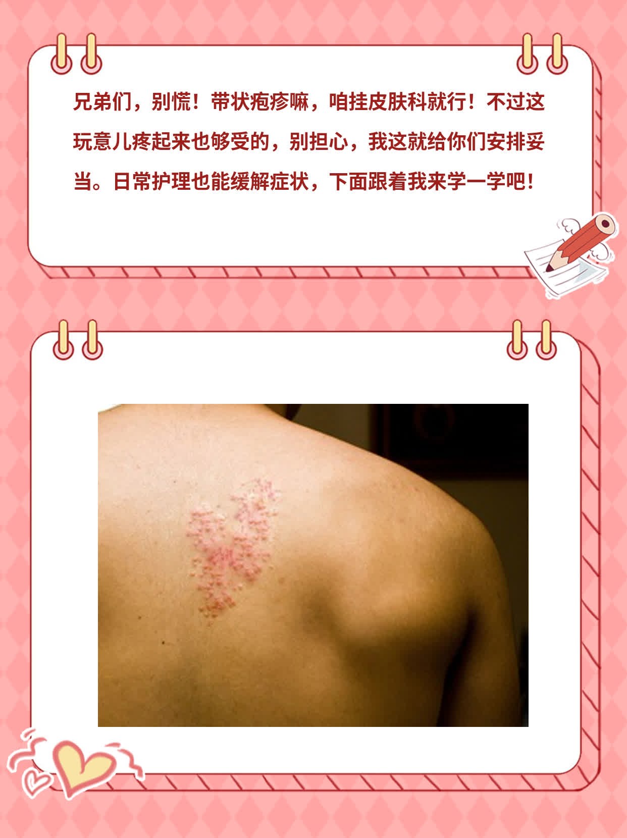 「带状疱疹」选科室？神经科or皮肤科？