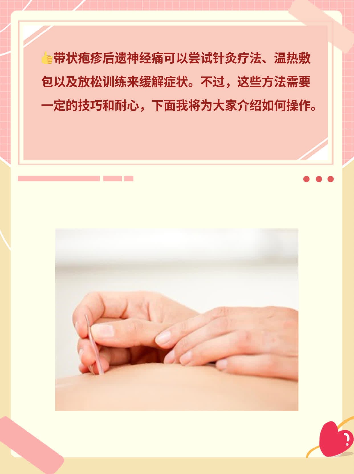 摆脱带状疱疹后遗神经痛的方法探秘！