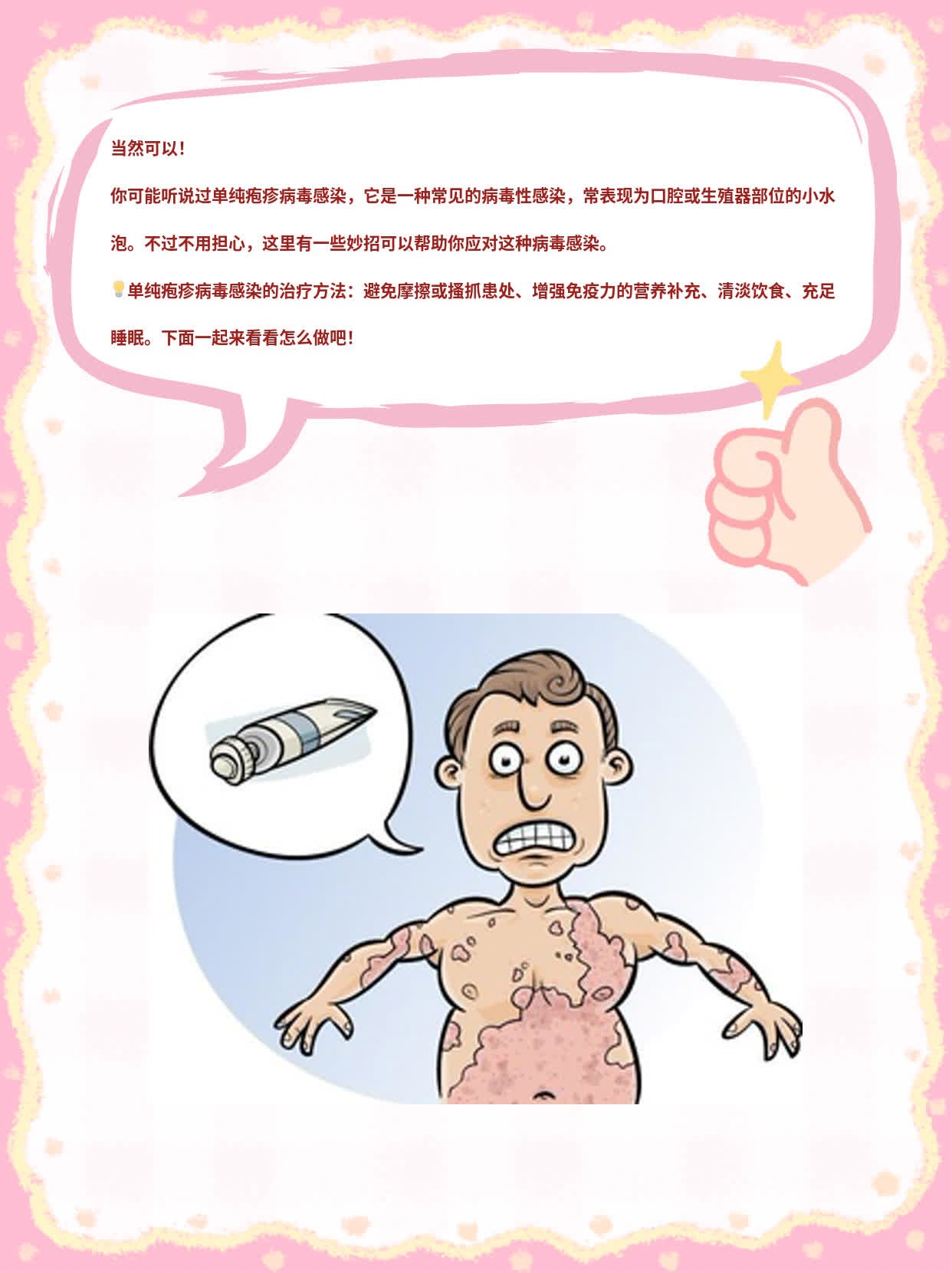「经验分享」单纯疱疹病毒感染治疗妙招