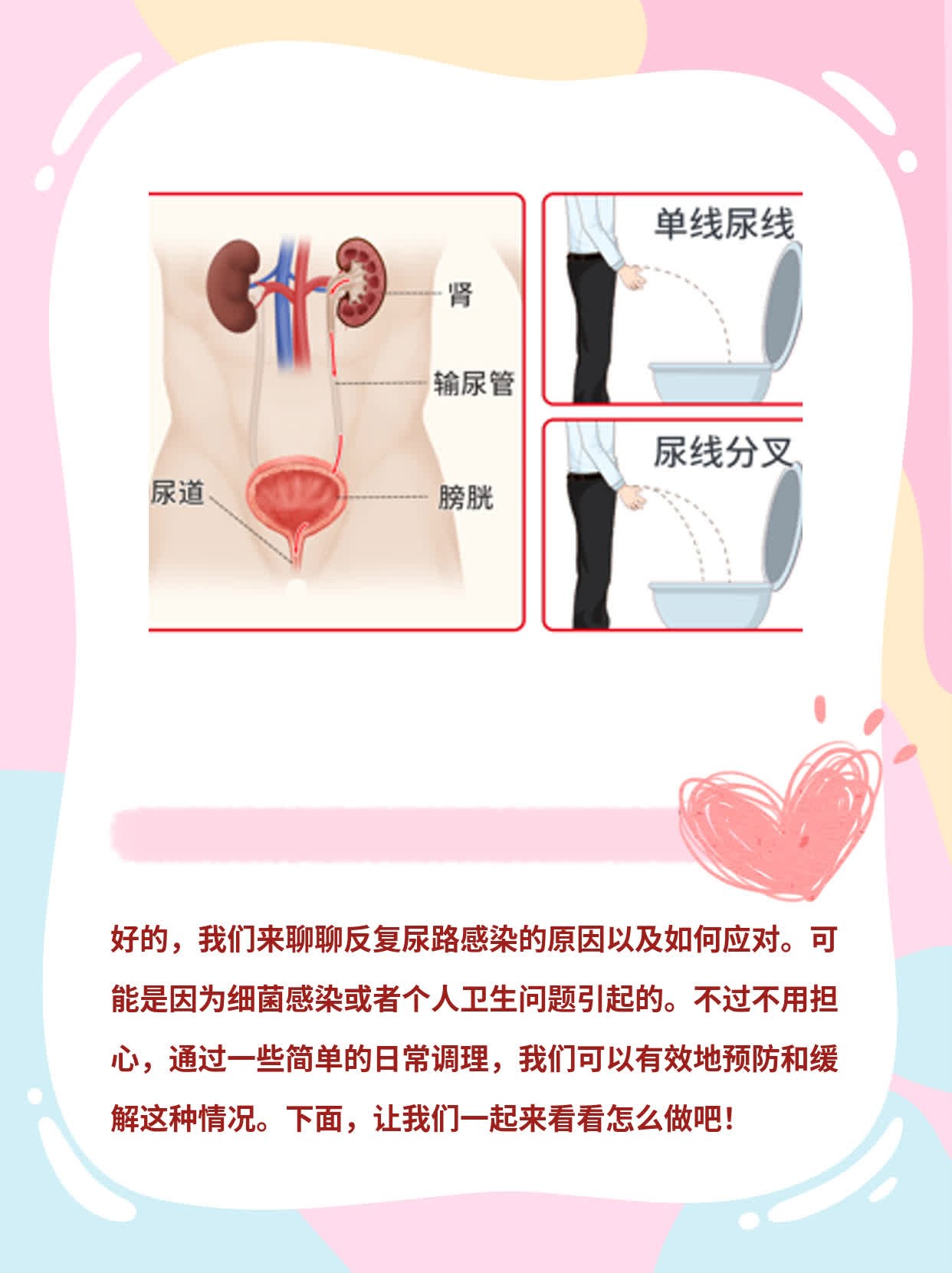 揭秘反复尿路感染的原因！