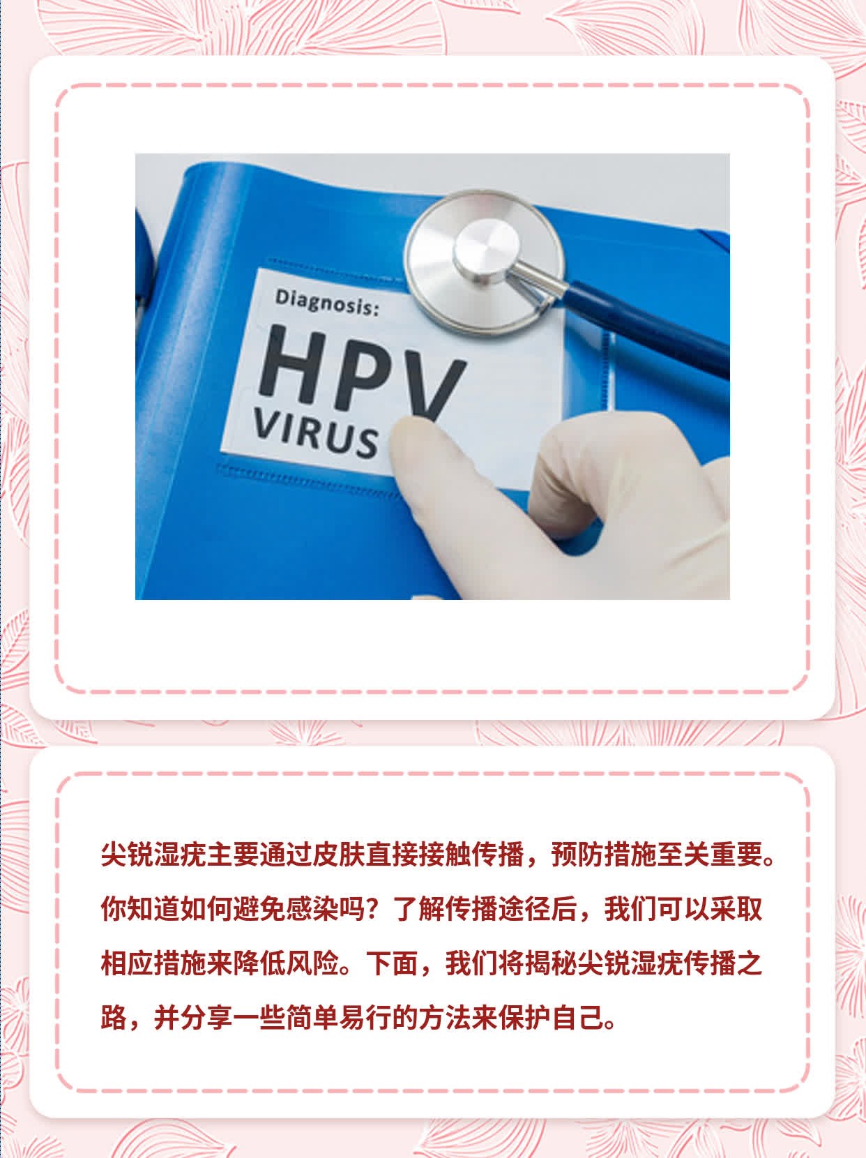 揭秘尖锐湿疣传播之路：你知道多少？