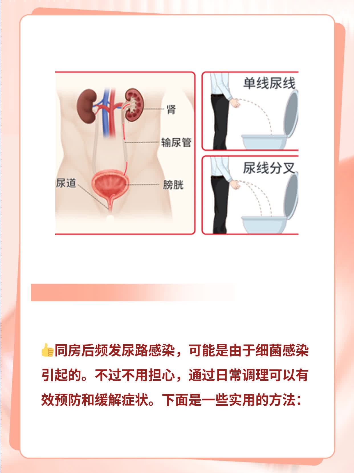 同房后频发尿路感染，揭秘背后的原因！