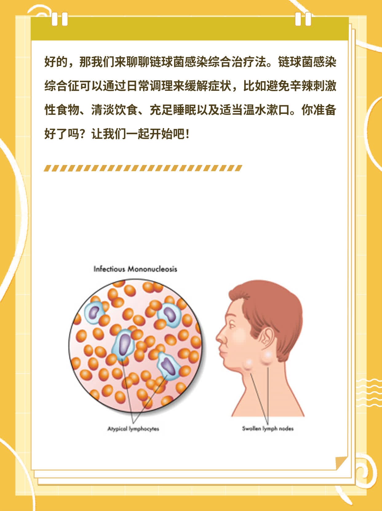 「分享」链球菌感染综合治疗法