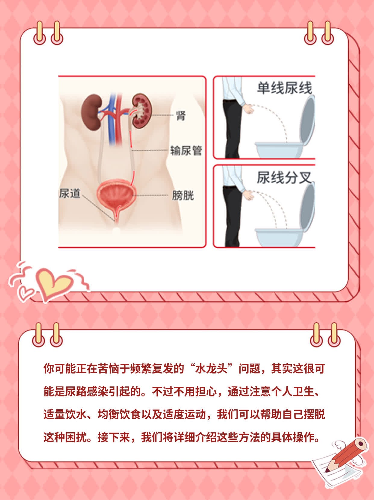 「憋不住尿」老是复发？教你摆脱“水龙头”问题！