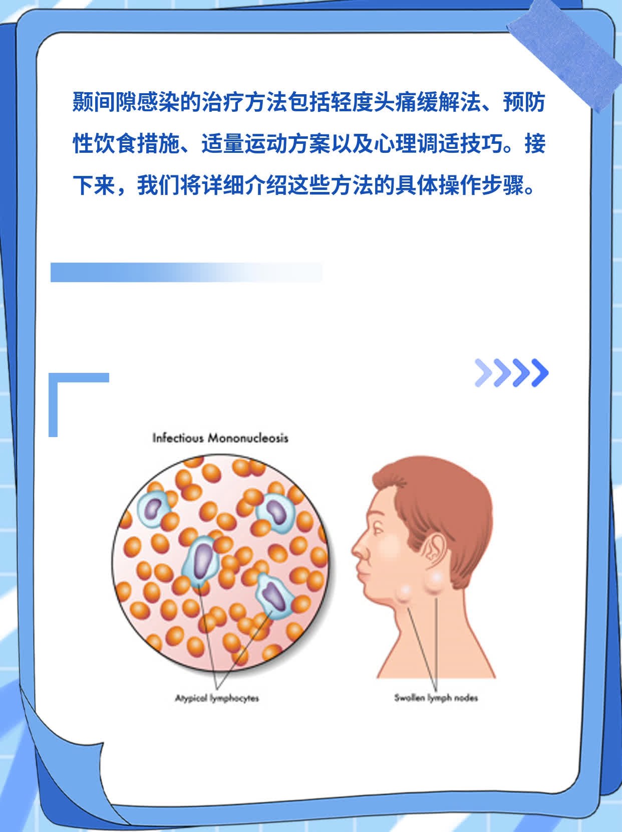 颞间隙感染治疗妙招分享！