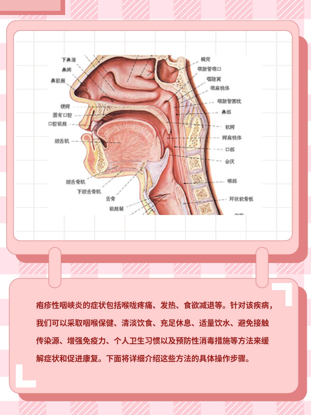 疱疹性咽峡炎症状及最佳疗法探秘