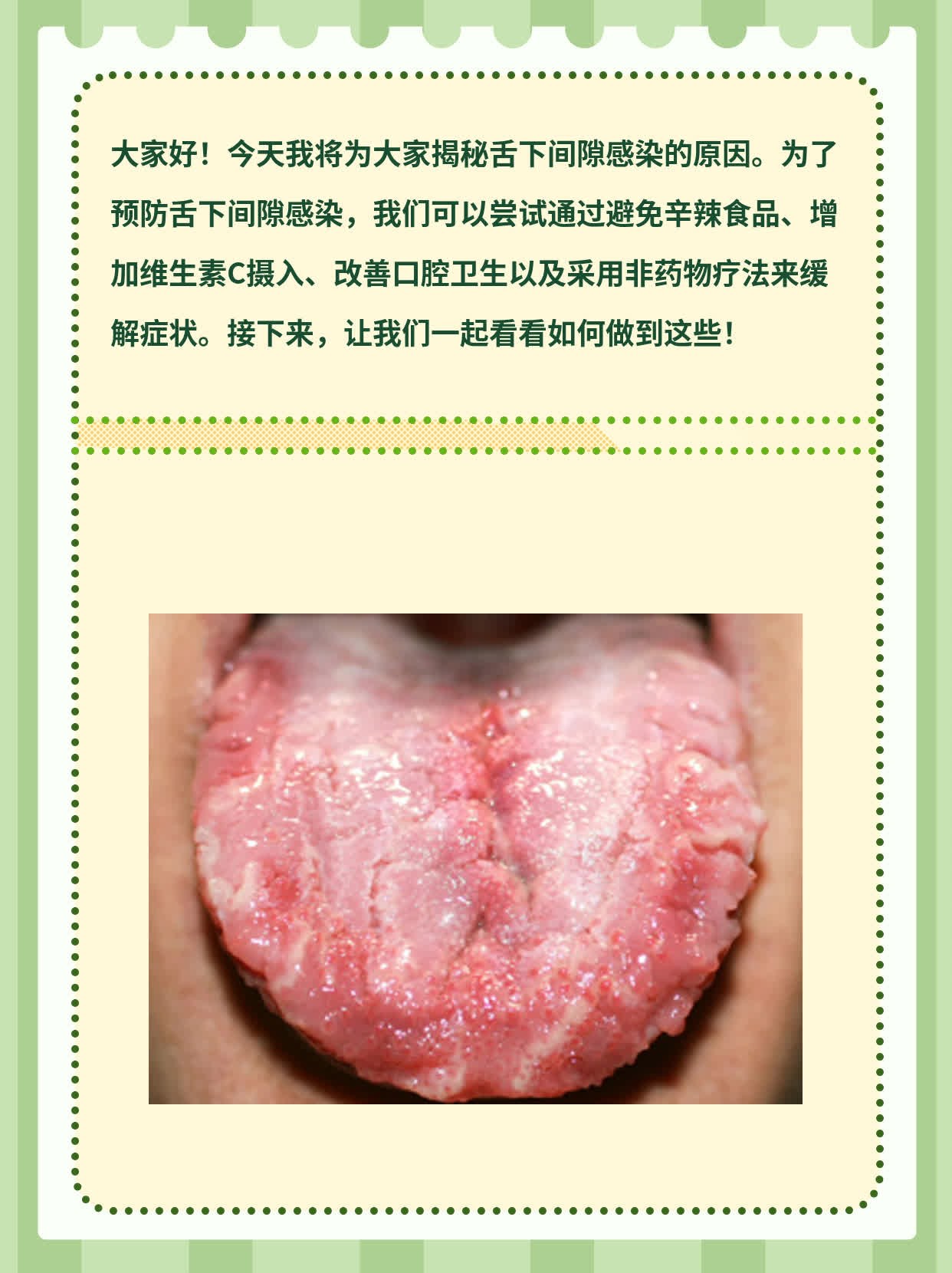 揭秘：舌下间隙感染诱因探析