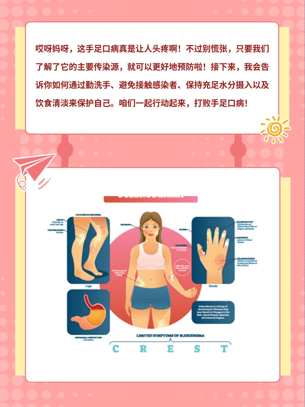 「手足口病」：揭秘主要传染源！