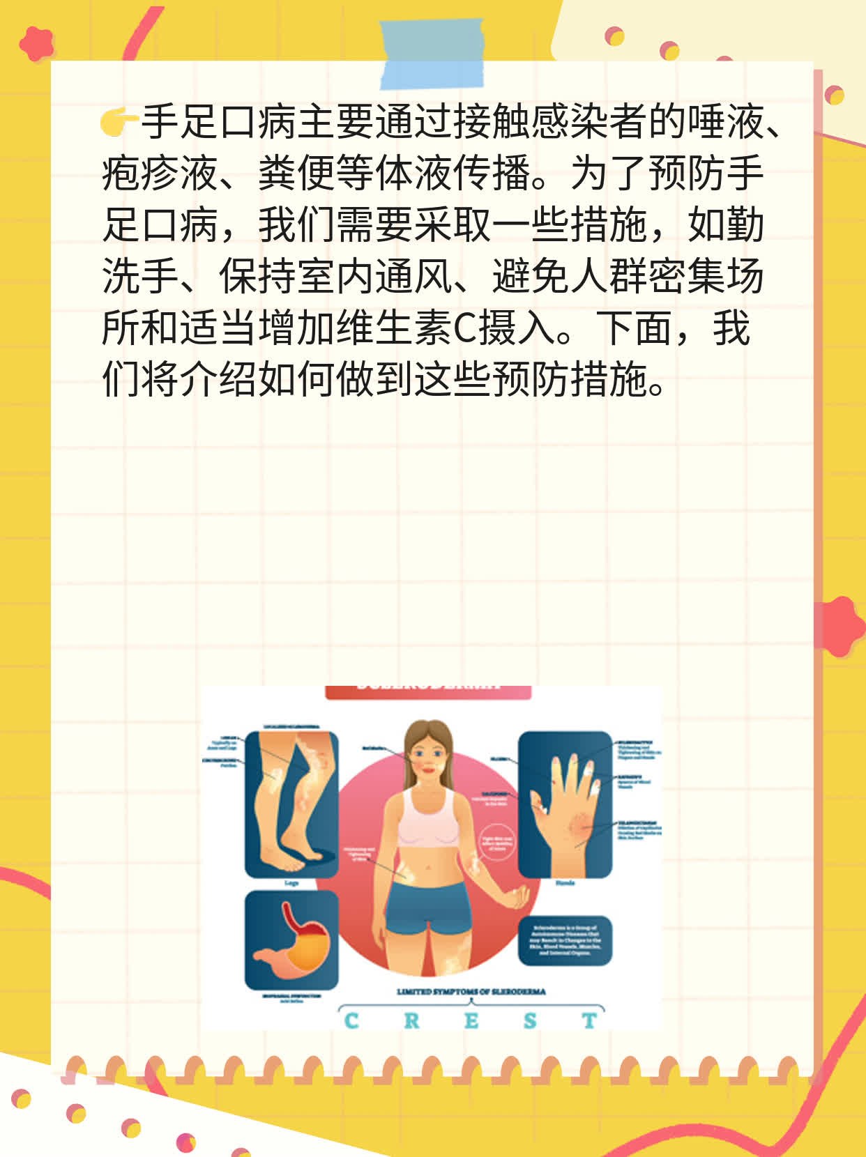 「手足口病」主要传播方式揭秘！