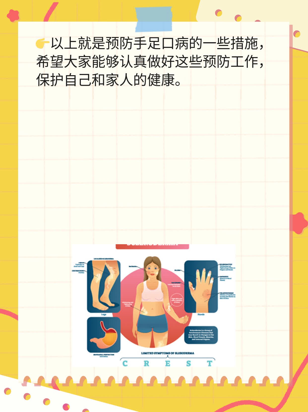 「手足口病」主要传播方式揭秘！