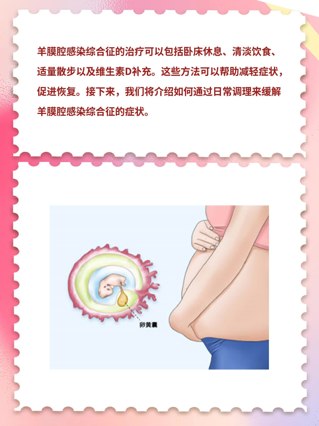 「经验分享」羊膜腔感染综合征治疗方法一览