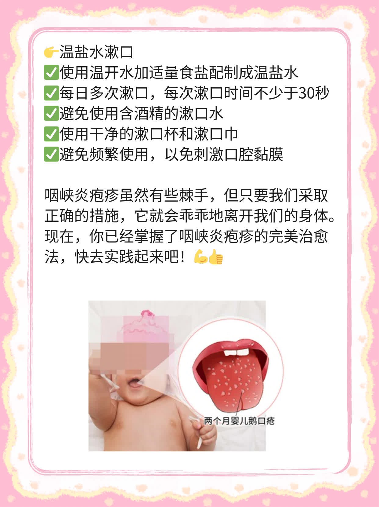 「咽峡炎疱疹」：症状揭秘+完美治愈法！