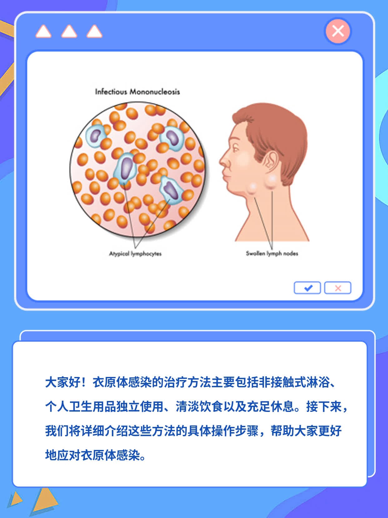 「经验分享」衣原体感染治疗方法一览