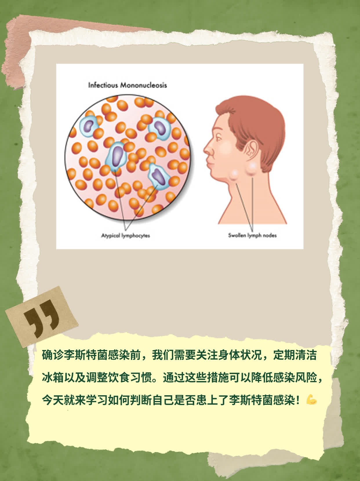 如何判断自己是否患上了李斯特菌感染？