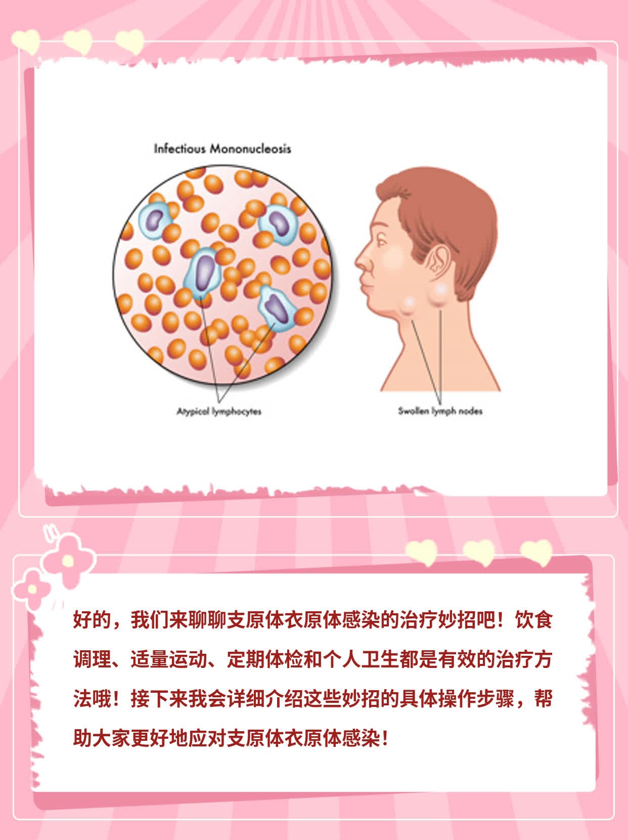 支原体衣原体感染的妙招：有效治疗方法分享！