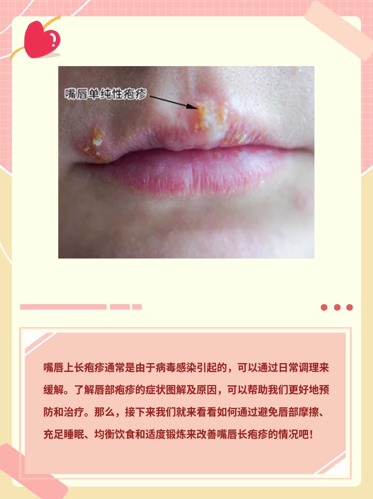 揭秘嘴唇长疱疹：症状图解及原因解析！