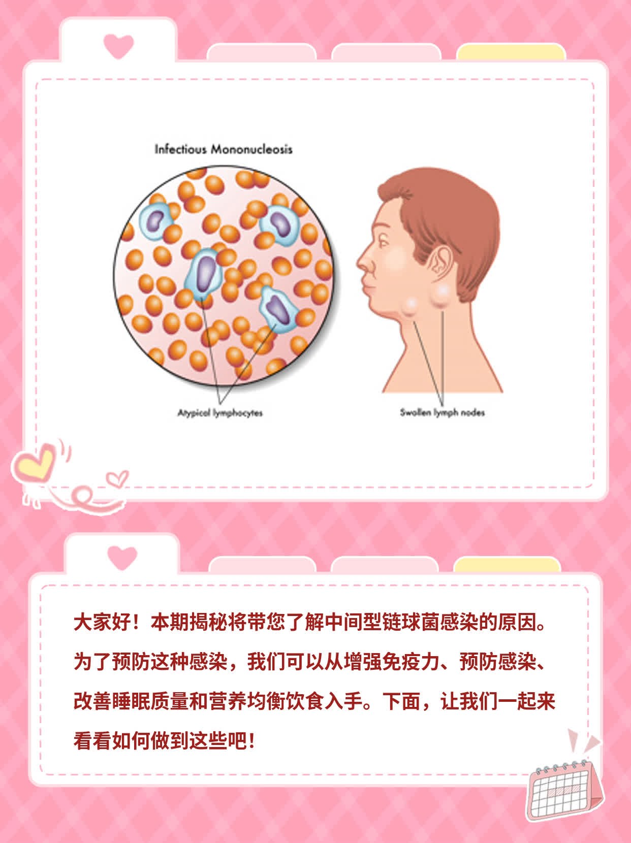 揭秘：中间型链球菌感染诱因探析