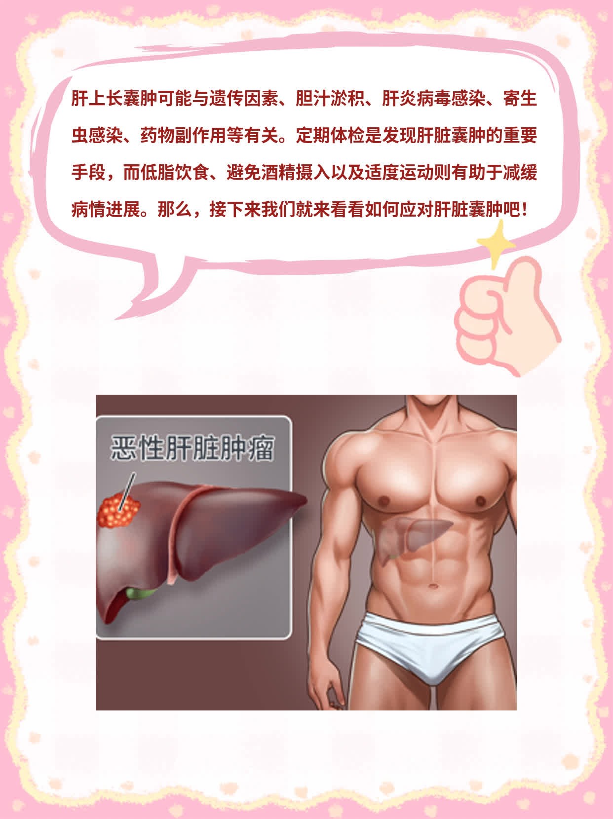 「解密肝脏囊肿」：探究病因及处理方法！