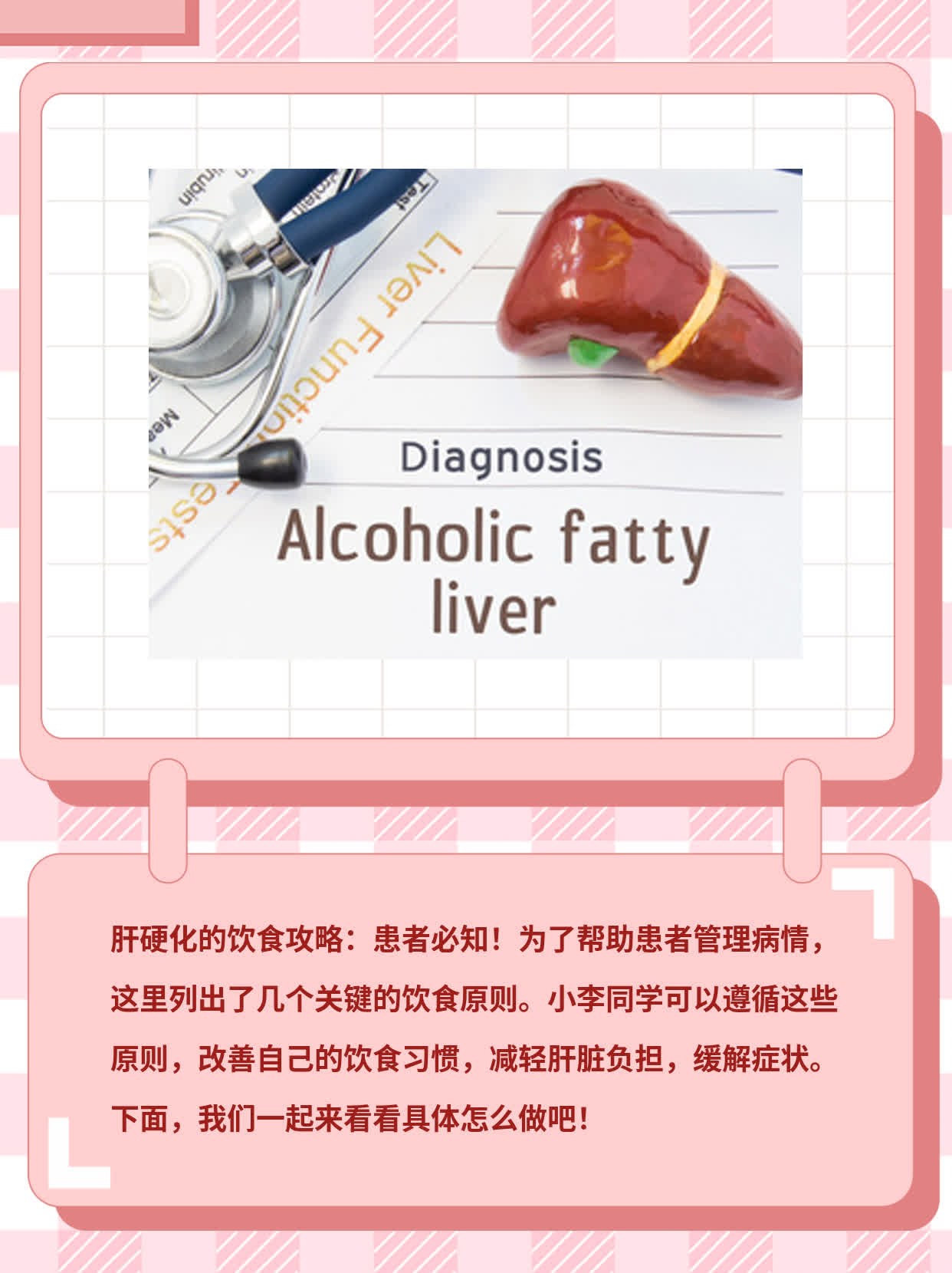 肝硬化的饮食攻略：患者必知！