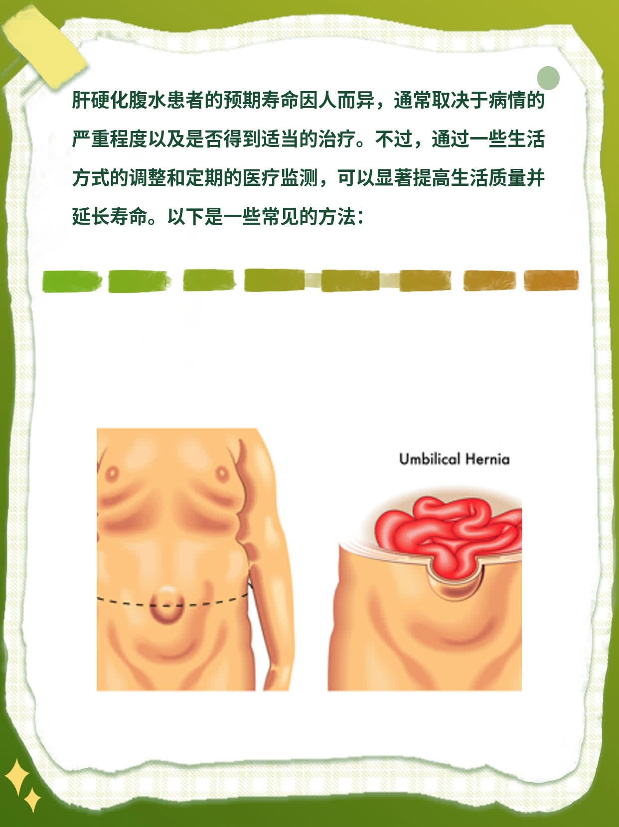 「问」肝硬化腹水影响寿命？