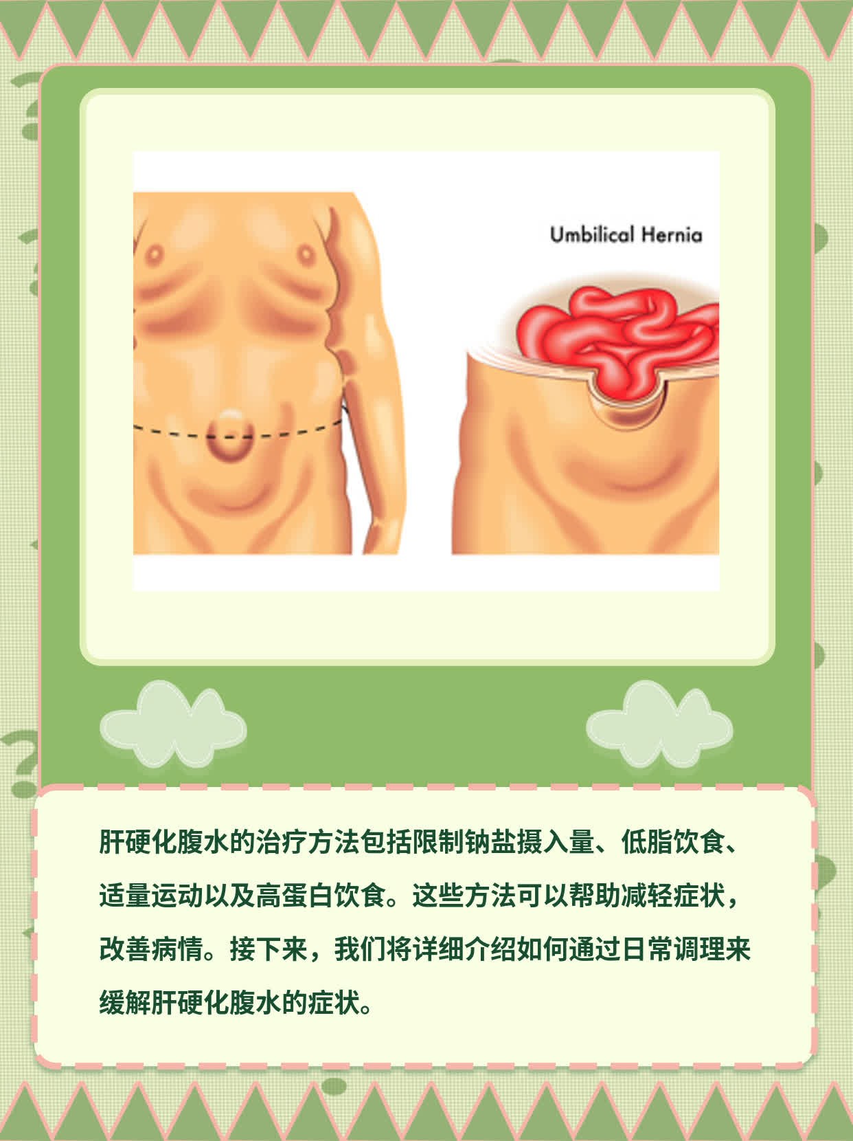 「经验分享」肝硬化腹水治疗方法一览
