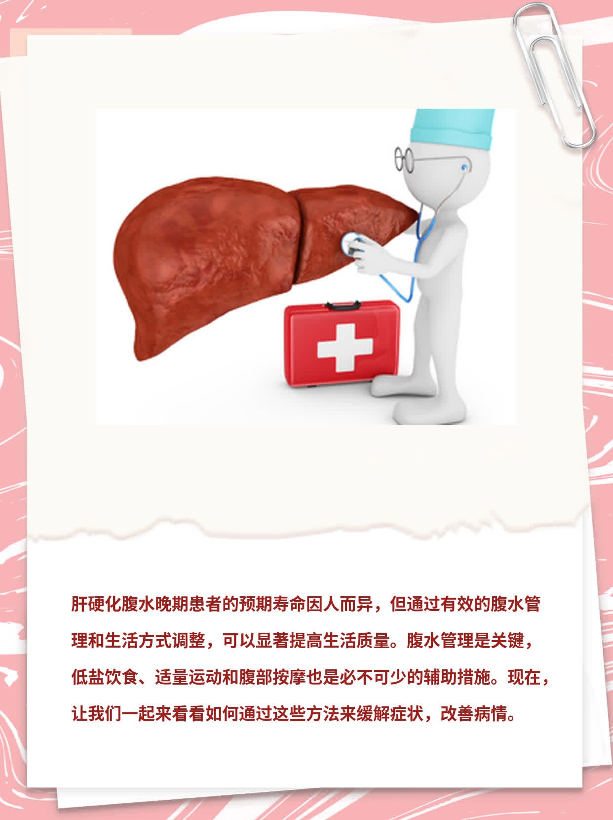 肝硬化腹水晚期患者预期寿命