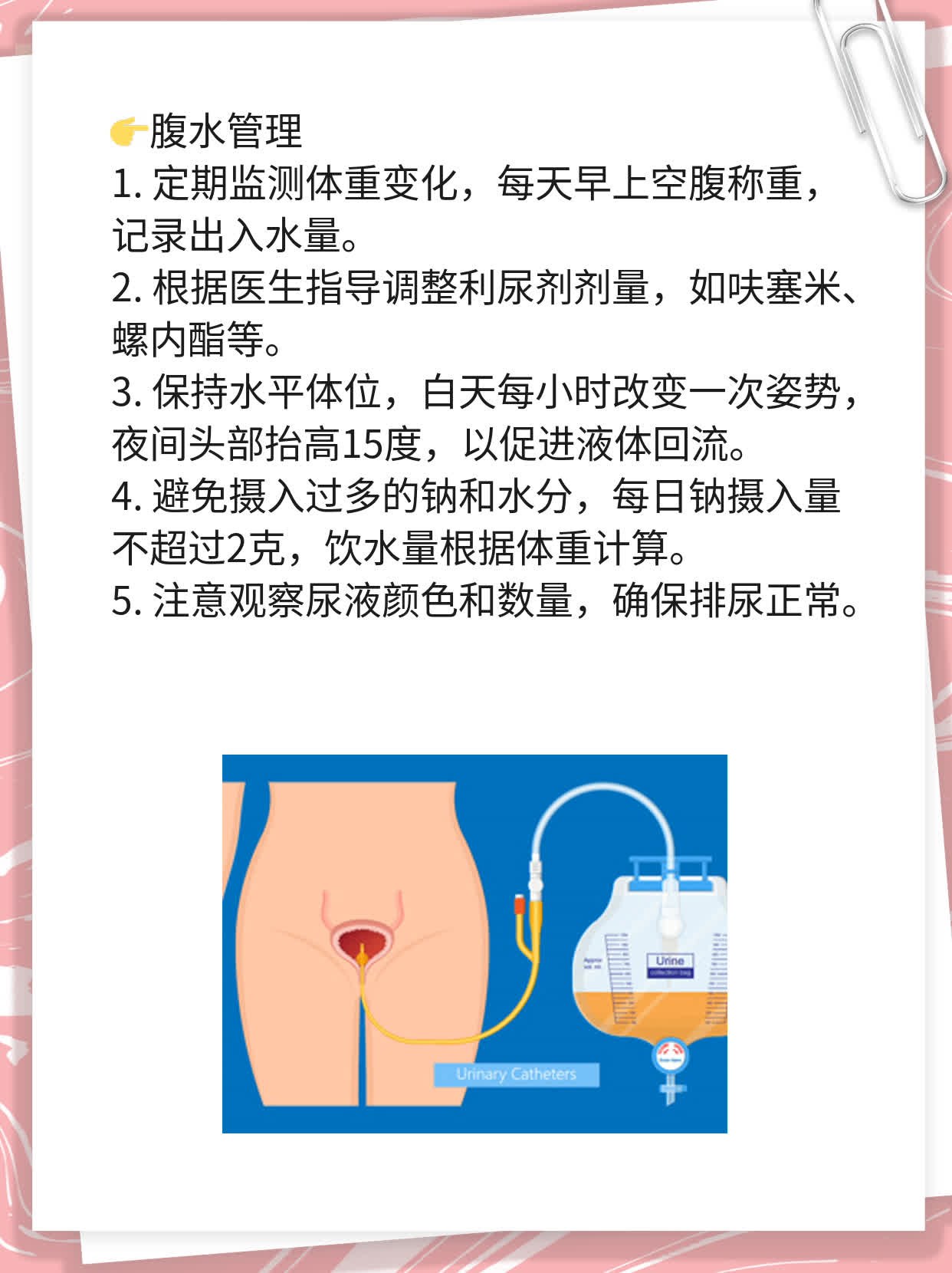 肝硬化腹水晚期患者预期寿命