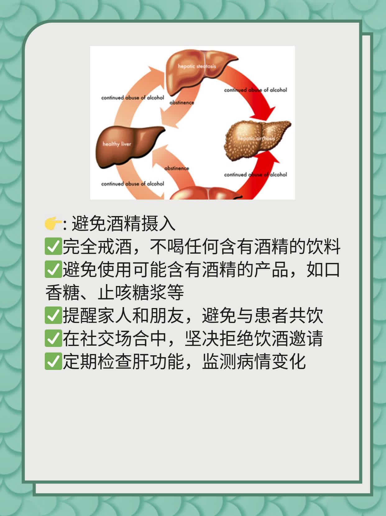 揭秘黄疸型肝炎症状：不容忽视的身体信号！