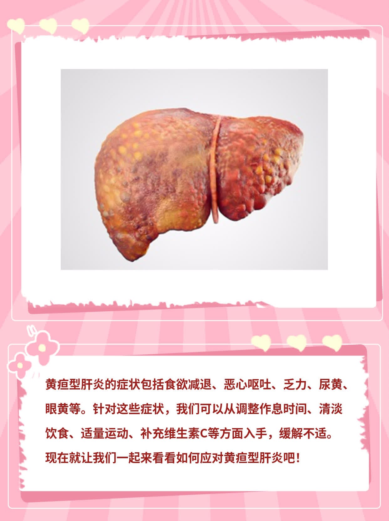 揭秘黄疸型肝炎的症状大全！