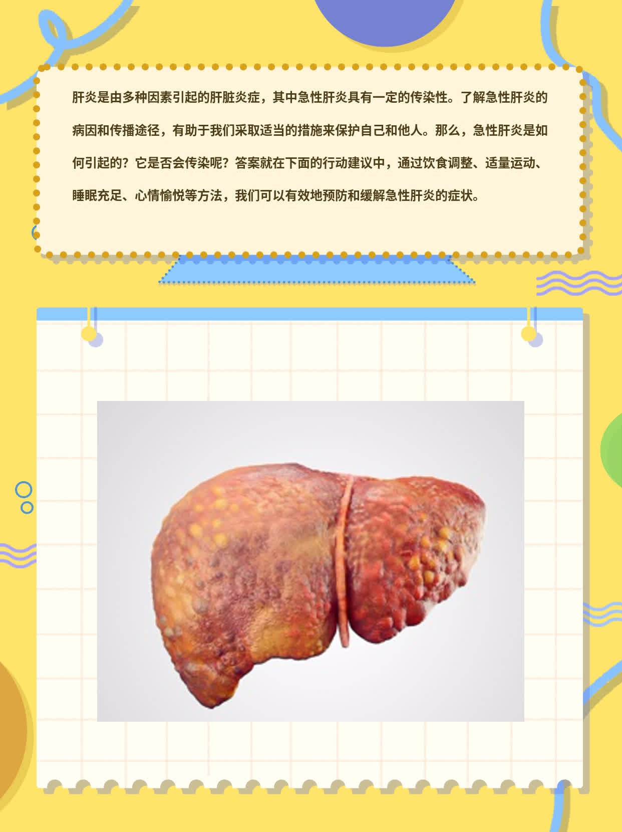 揭秘急性肝炎：病因及传染性大公开！