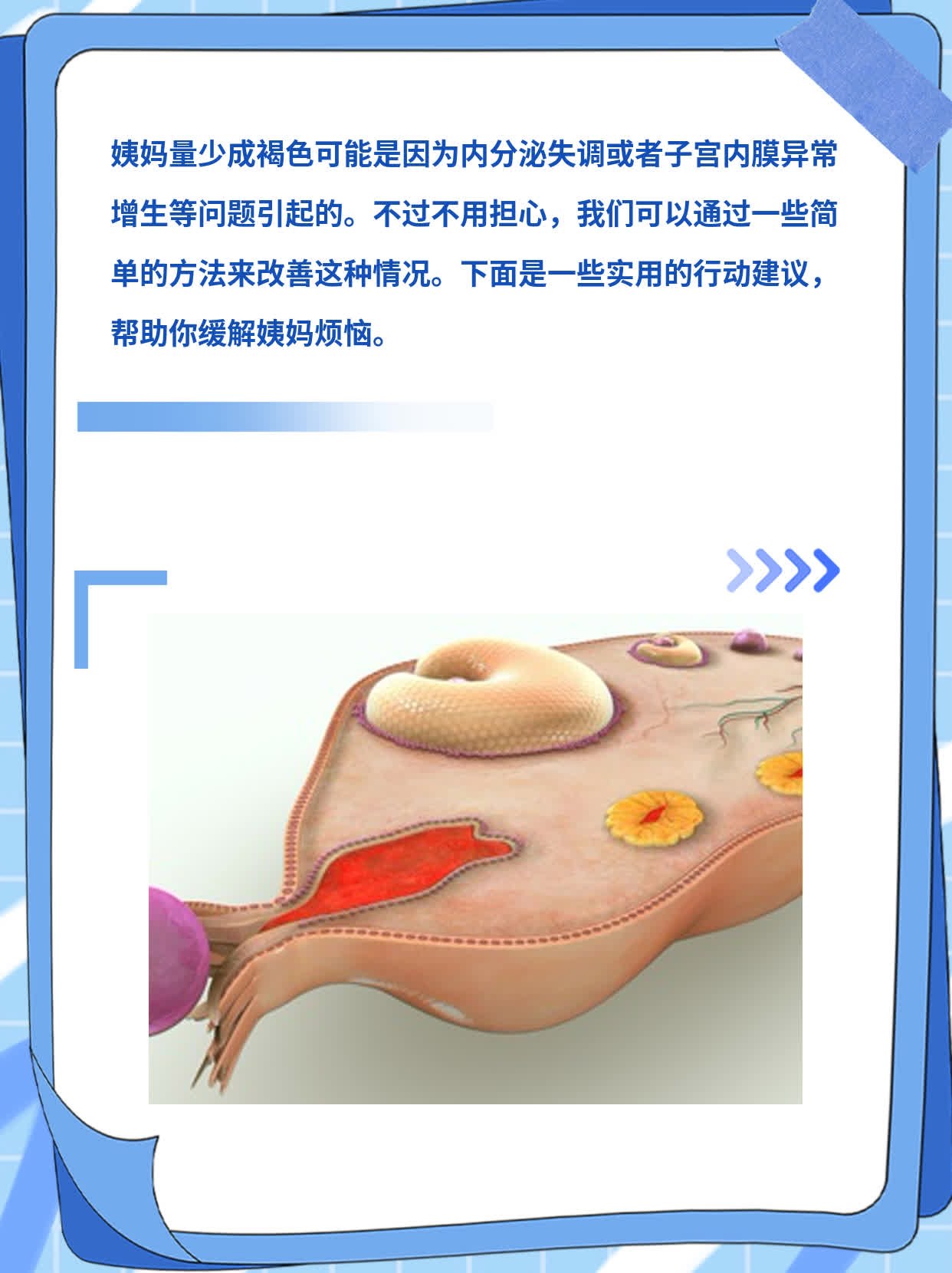 「姨妈烦恼」：姨妈量少成褐色？