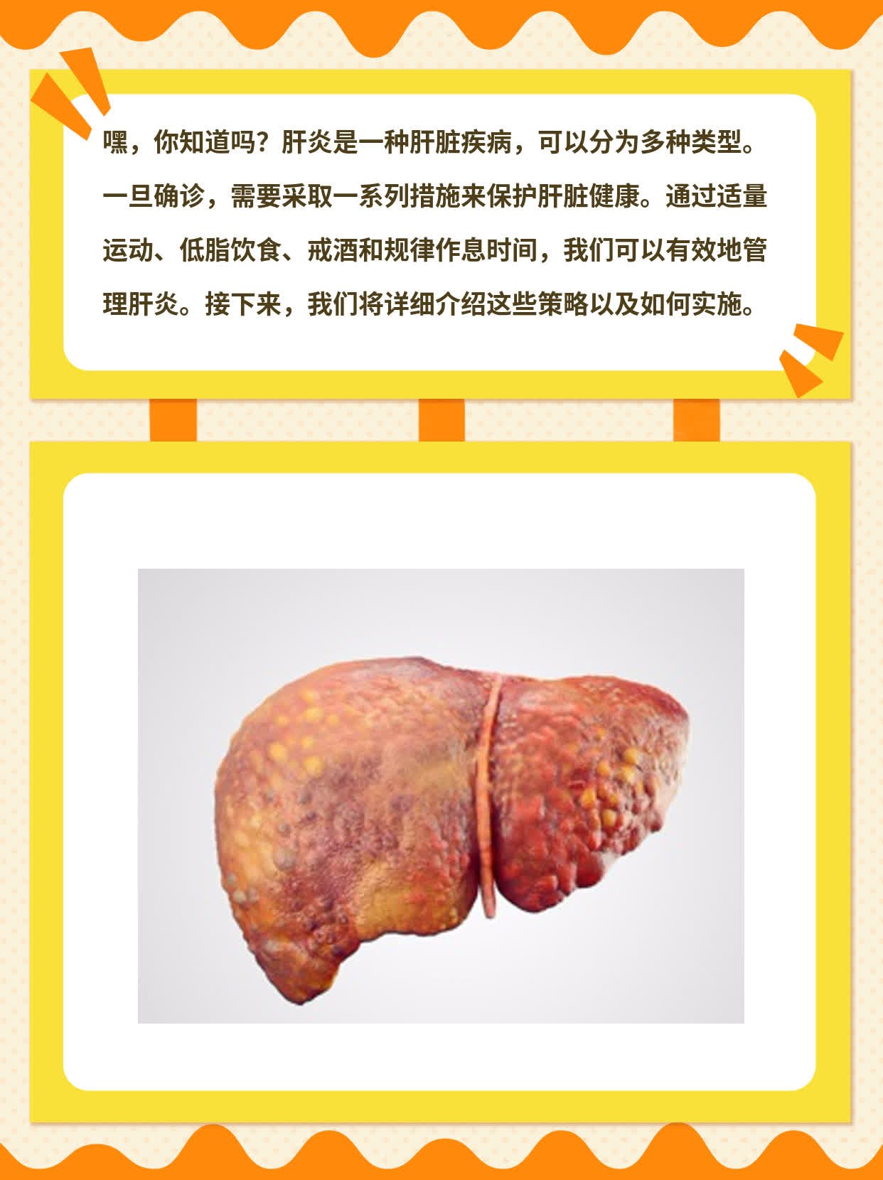 「揭秘」肝炎大作战：诊断&处理策略全攻略！