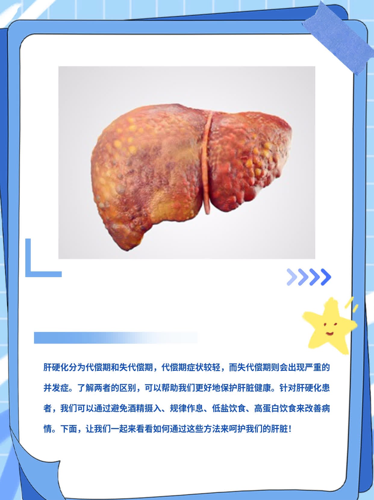 #揭秘肝硬化的“代偿”与“失代偿”区别！