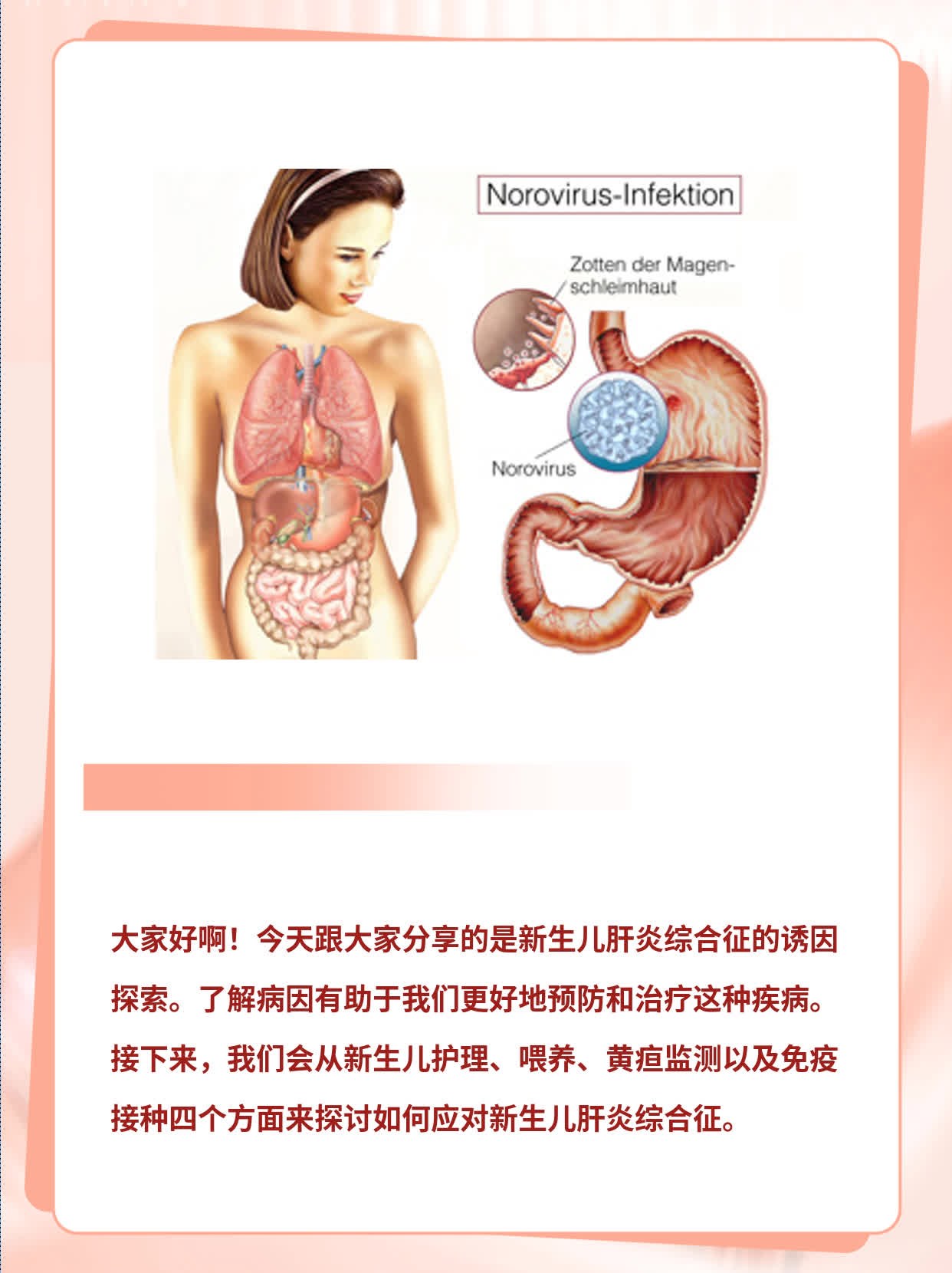 揭秘新生儿肝炎综合徵诱因：探究病因指南
