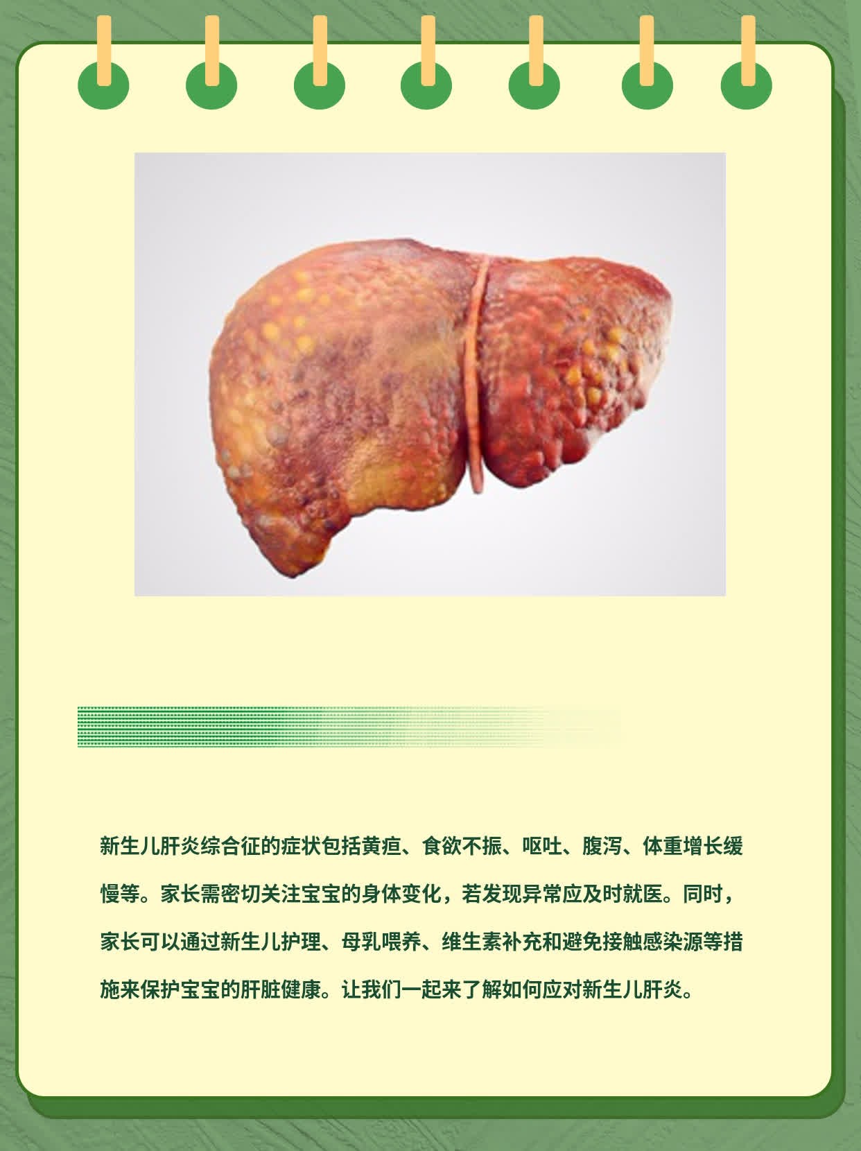 「新生儿肝炎」：宝宝肝脏出问题了！