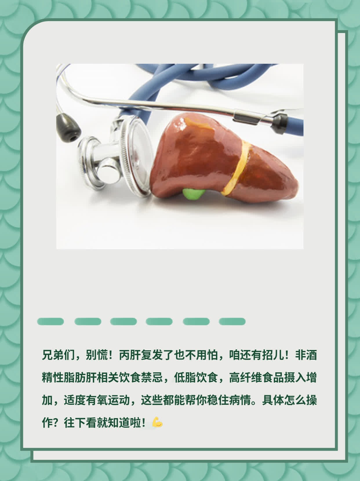 丙通沙治丙肝复发了咋办？