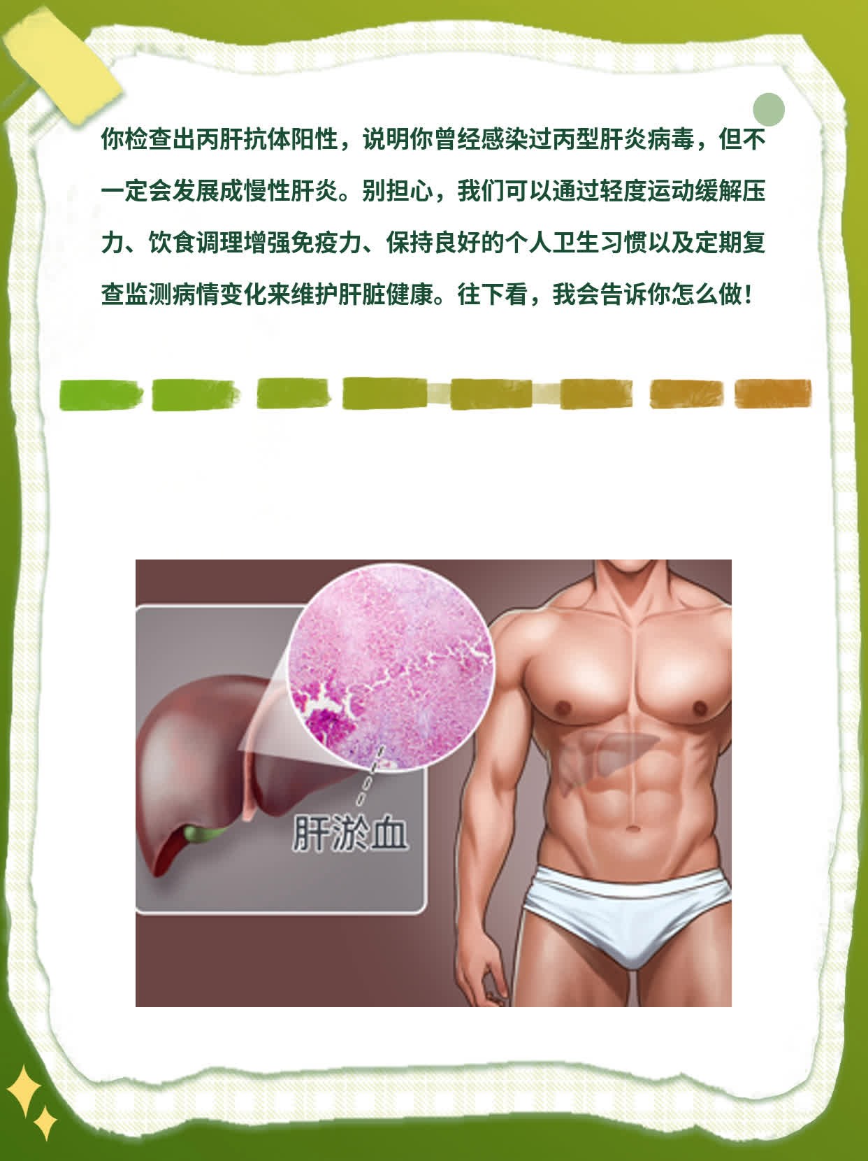 丙肝抗体阳性？解密肝脏健康警示信号！