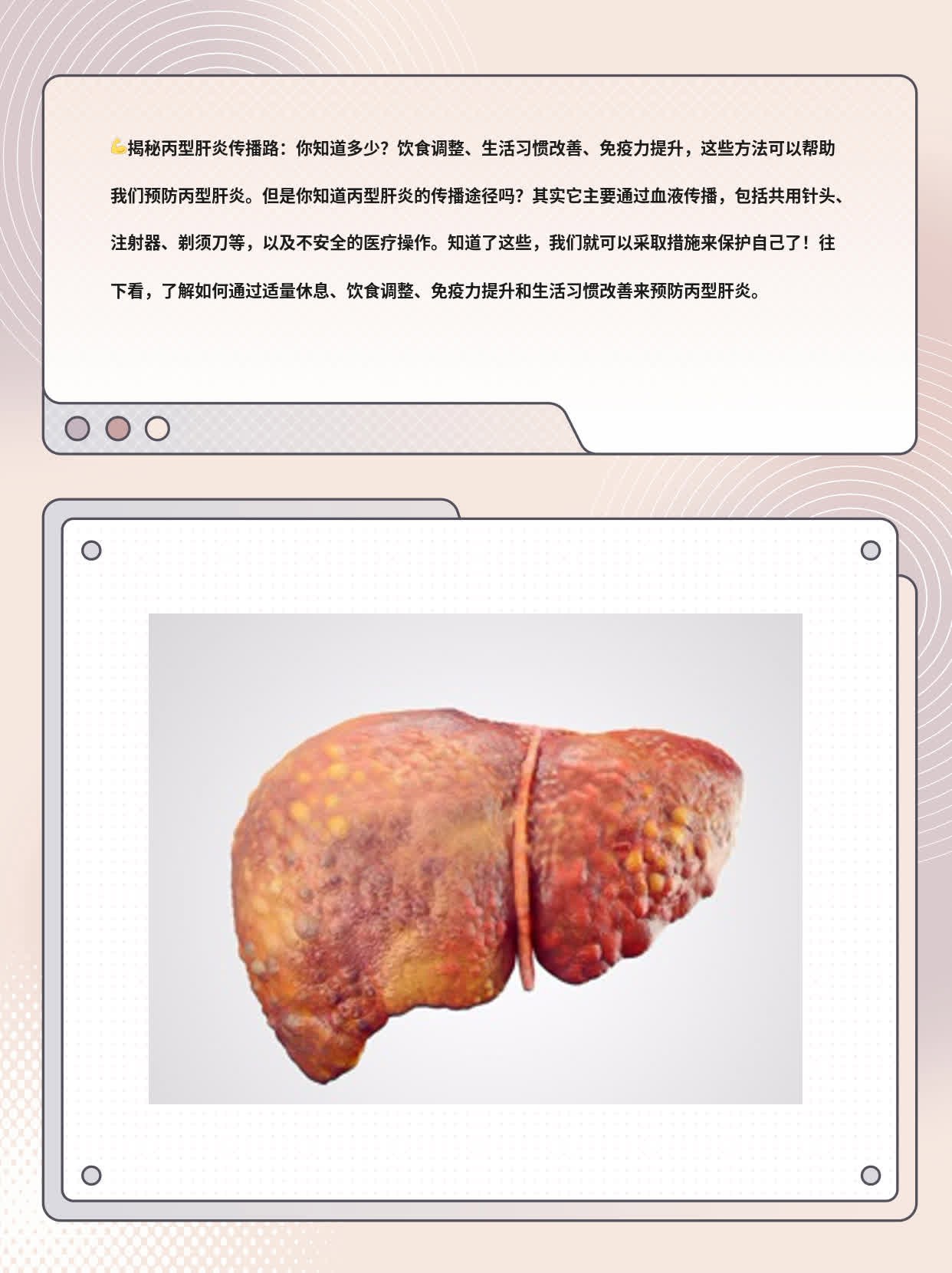 揭秘丙型肝炎传播路：你知道多少？