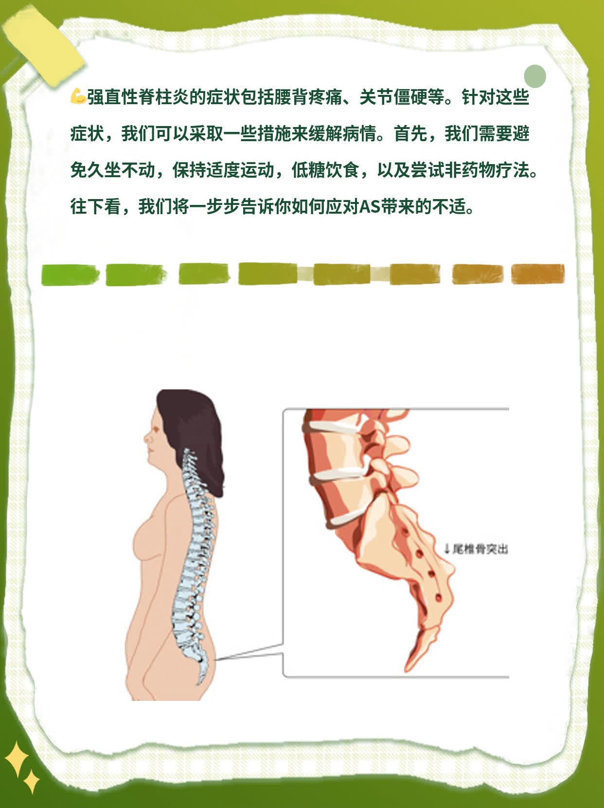 「AS必备指南」：强直性脊柱炎的症状一览表