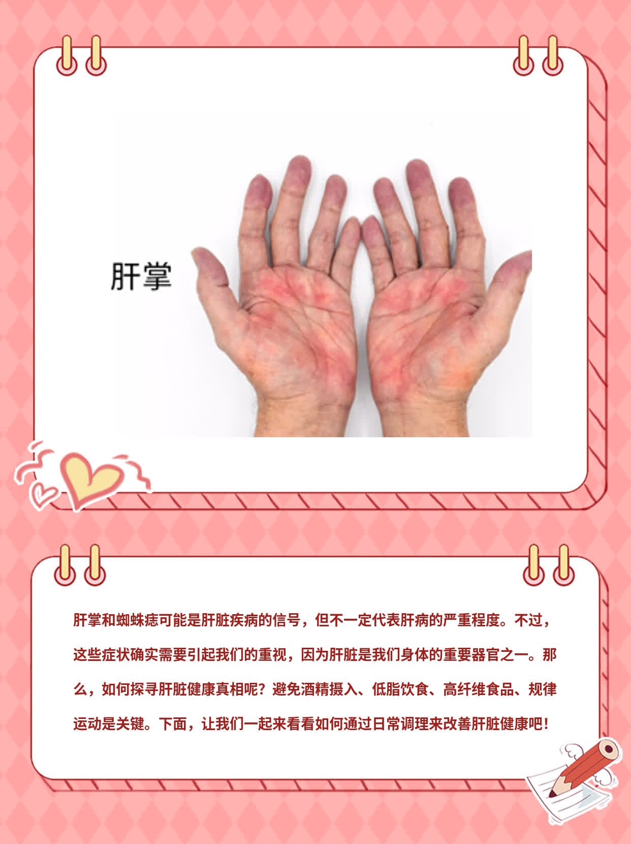 「肝掌&蜘蛛痣」=肝病严重？探寻肝脏健康真相！