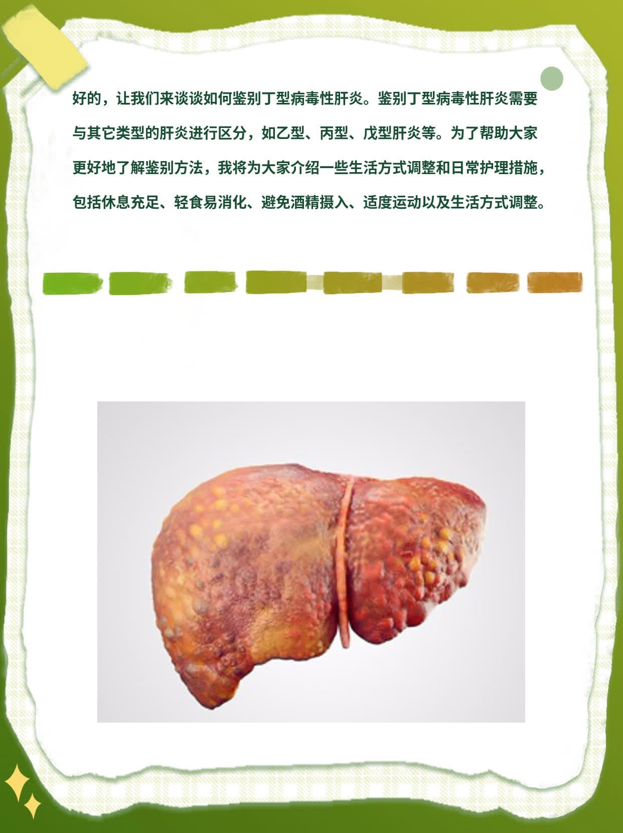 「经验分享」如何鉴别丁型病毒性肝炎？