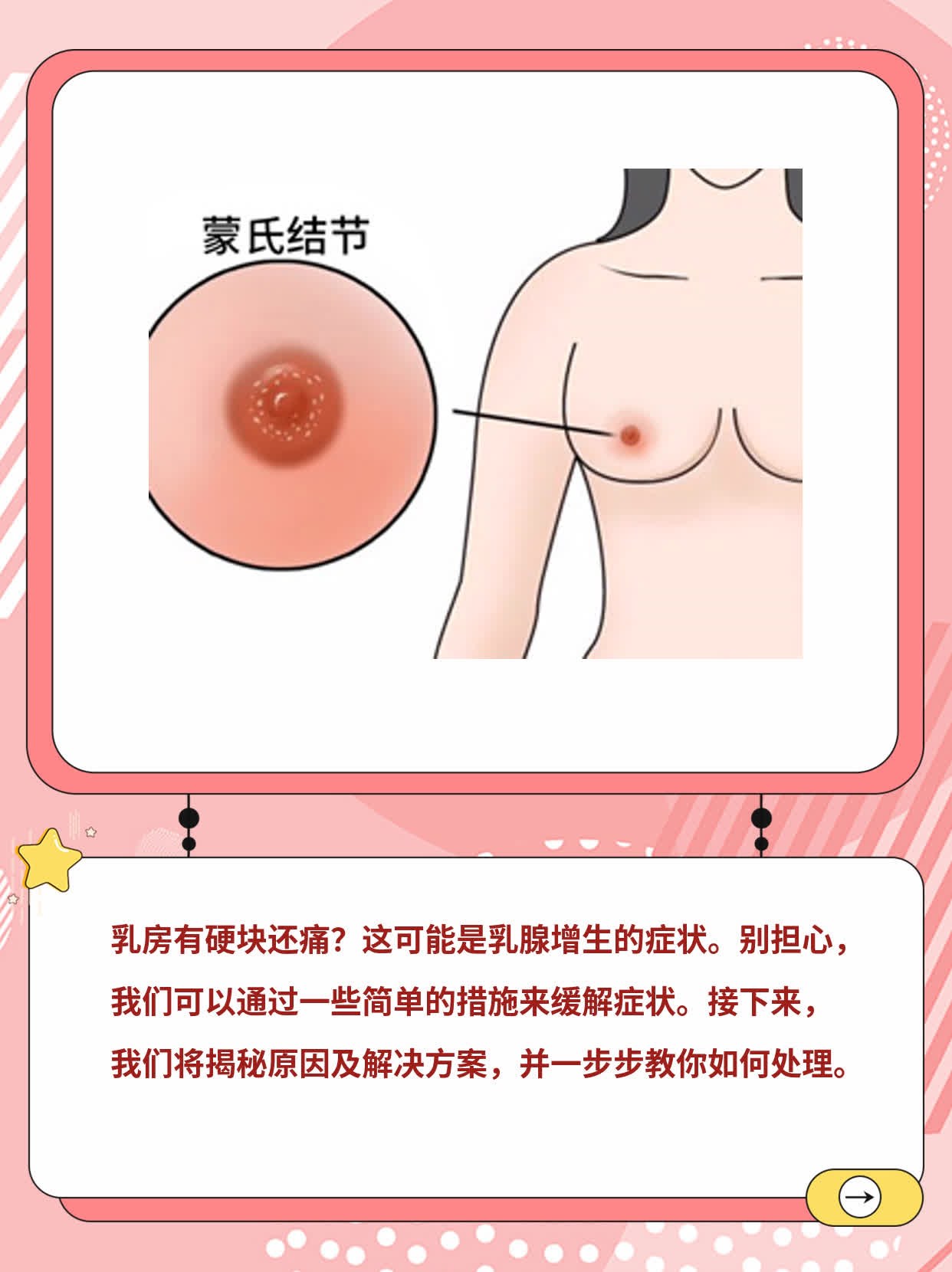 乳房有硬块还痛？揭秘原因及解决方案！