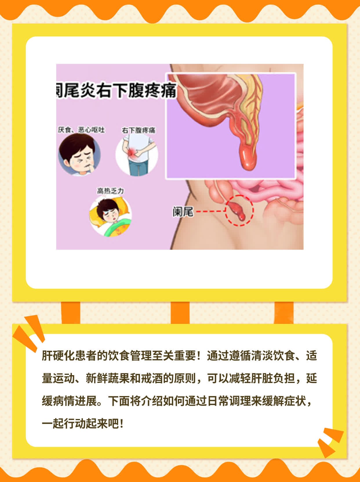 肝硬化患者必看！饮食攻略来啦！