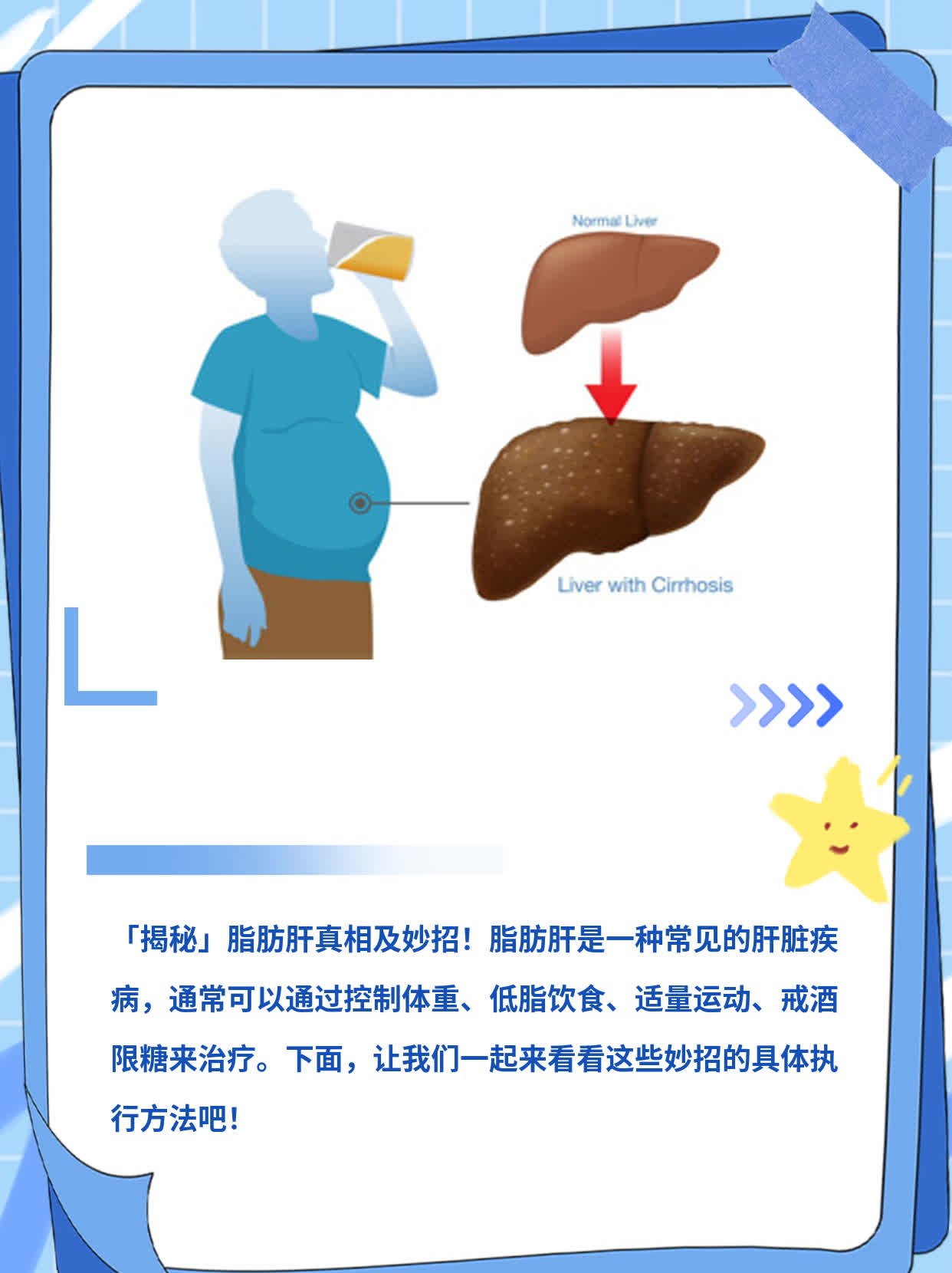 「揭秘」脂肪肝真相及妙招