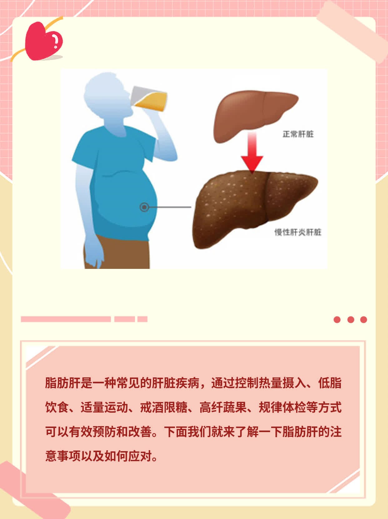探秘脂肪肝：预防与注意事项