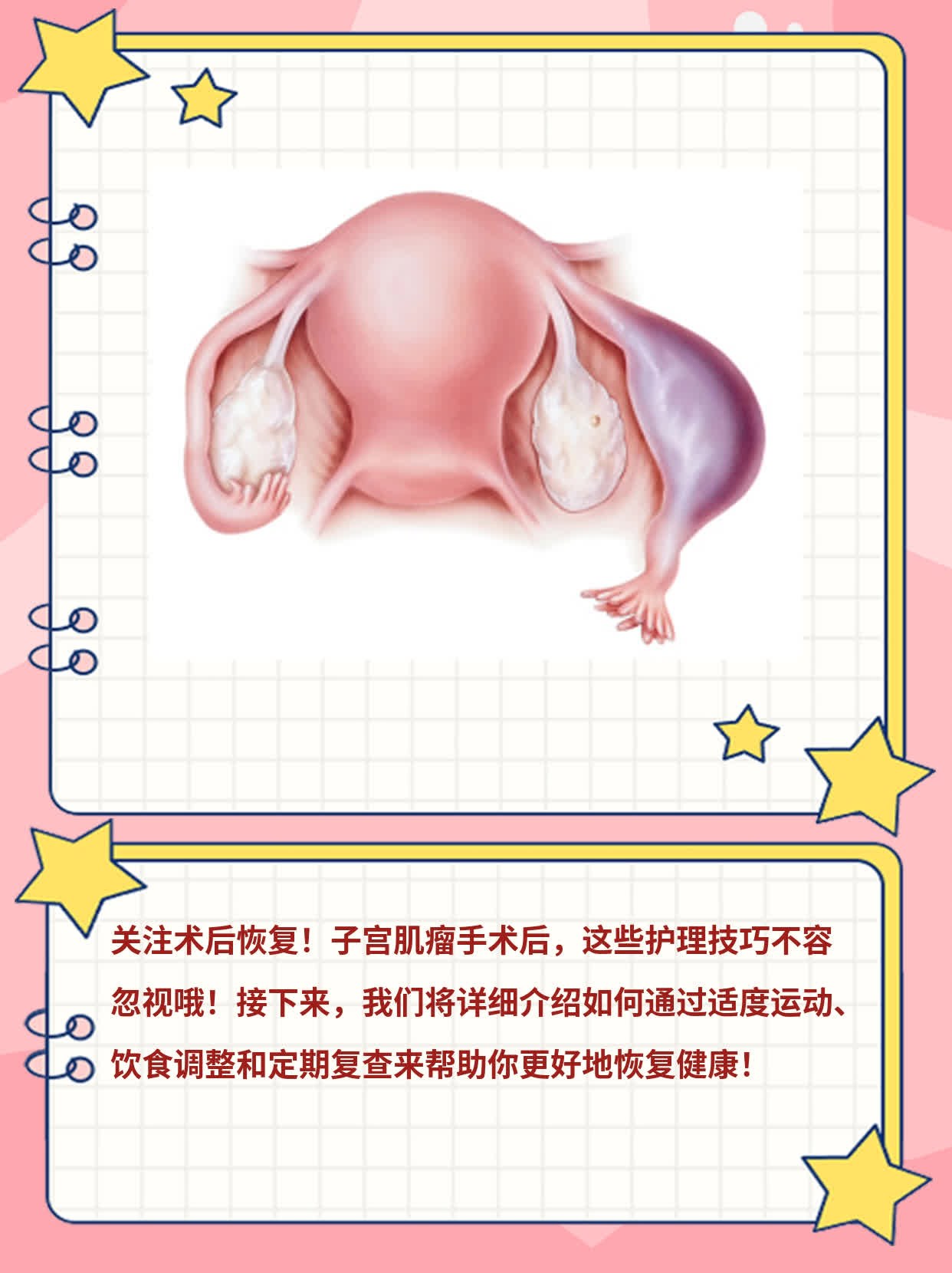 【经验分享】术后注意！子宫肌瘤手术后的护理攻略