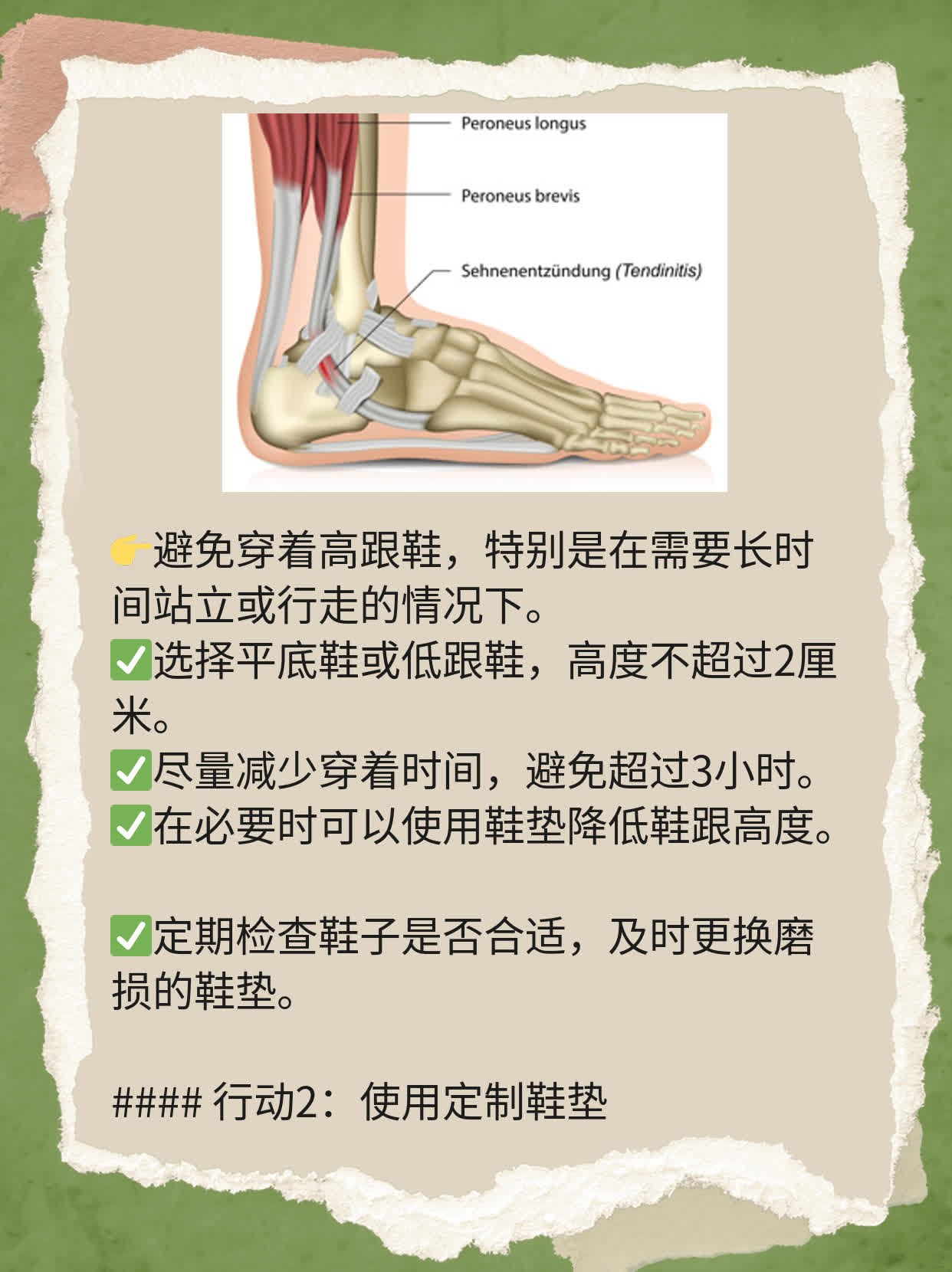 「足部科普」：大脚趾骨头痛，原来是它在作怪！