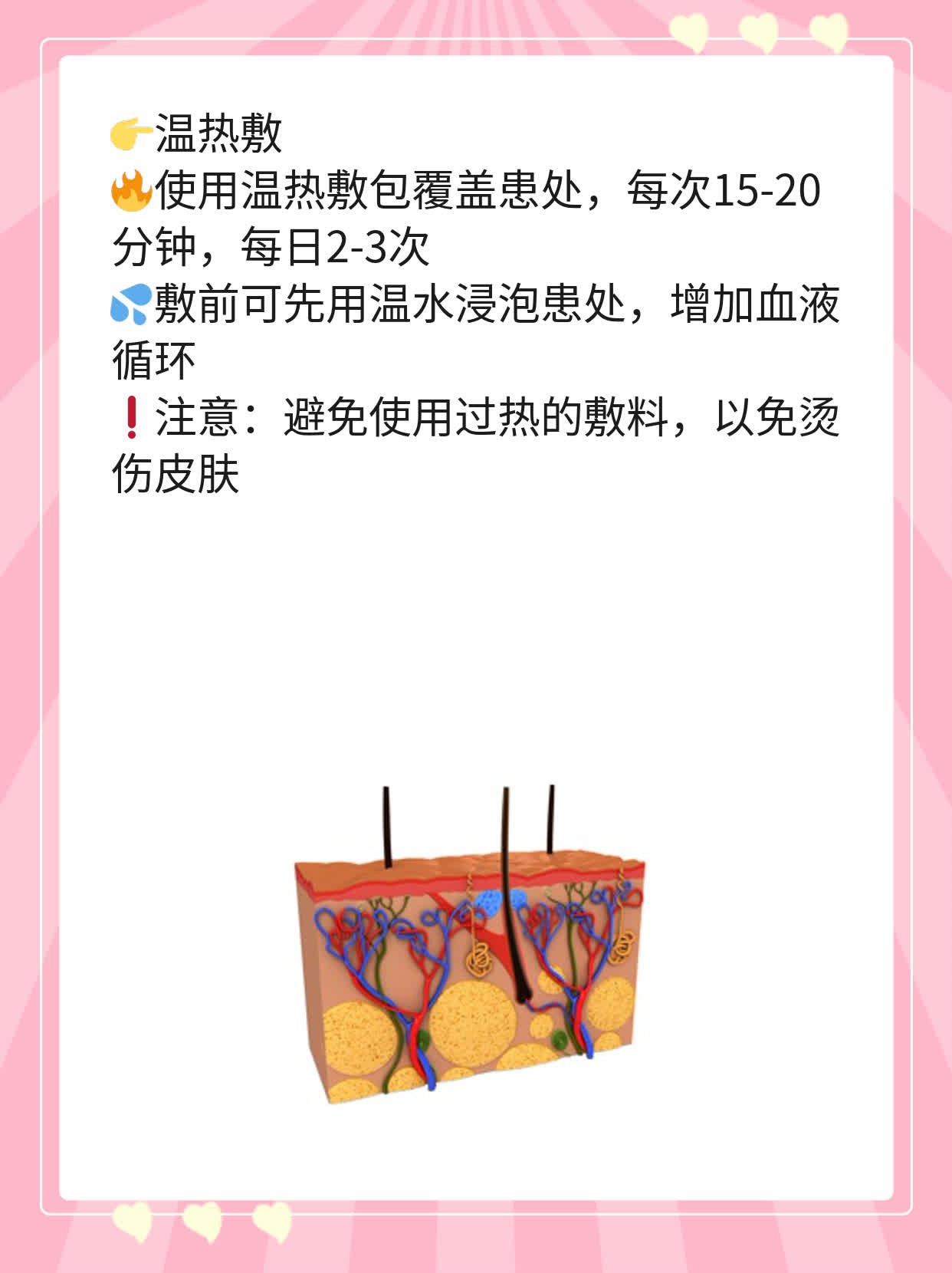 「手疼」原来是它在作怪！手指关节红肿疼痛的原因探秘