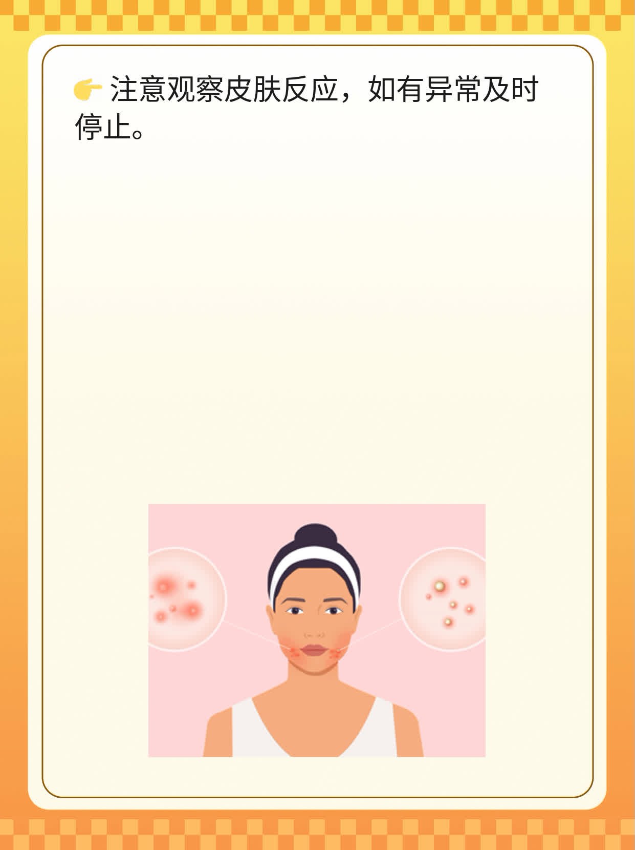 椎间盘突痛快解法：简单妙招舒缓神经！