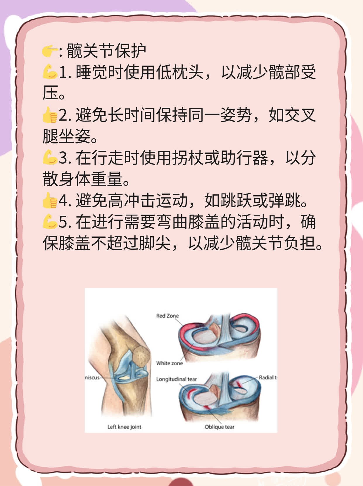 探秘髋关节脱位诱因：一份实用的经验分享